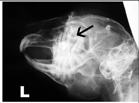 Figure 1 From Treatment Of A Retrobulbar Abscess Secondary To Dental