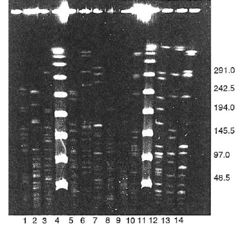 Smai Restriction Endonuclease Patterns Obtained By Pulse Field Gel