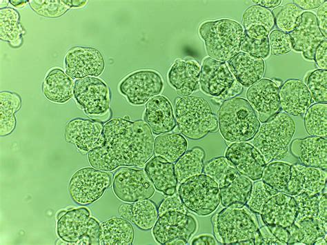 Entamoeba Histolytica Cyst With Label