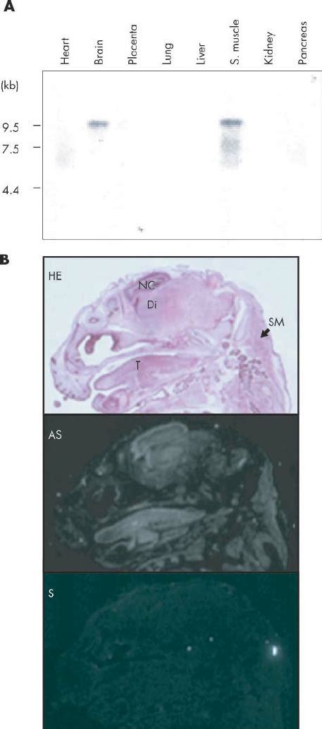 A Northern Blot Analysis Of The Human Ppp1r9a Gene On Human Adult