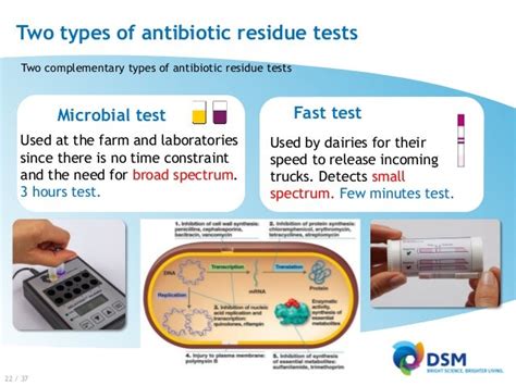 Antibiotic Residues In Milk Risk For Consumers And Processors