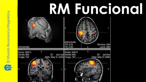 Los Secretos Detr S De La Resonancia Magn Tica Funcional Cerebral