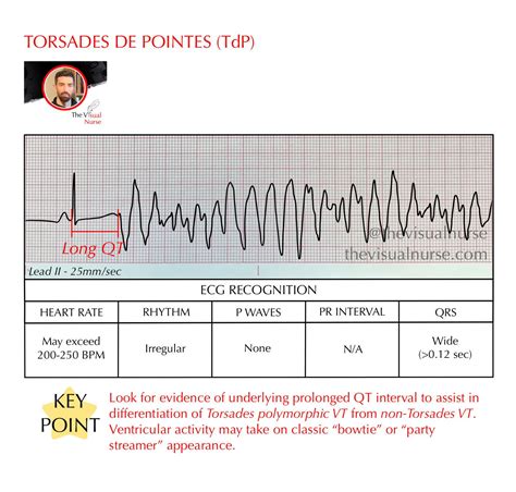 Torsades De Pointes Tdp On The Ecg For Nurses And Nursing Students