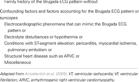 Diagnostic Criteria Of Brugada Syndrome Brugada Ecg Pattern