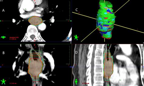 Frontiers Inter Observer And Intra Observer Variability In Gross