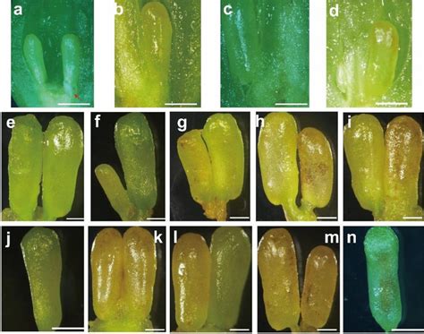 The Variation In Ovules Phenotypes At Different Sampling Time In