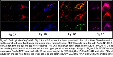 Metallic nanoparticles can kill cancer cells leaving healthy ones intact, say researchers