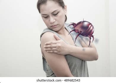 Female Rash Allergic Dust Mites Dust Stock Photo 489682549 | Shutterstock