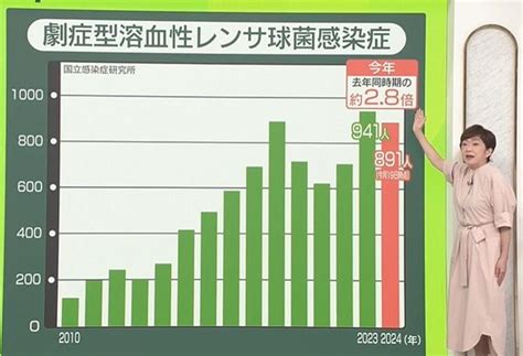 “人食い”の異名も──致死率3割「劇症型溶連菌」の感染、過去最多ペース 毒素「9倍」変異株が流入か 飛まつ感染も？（2024年5月30日掲載