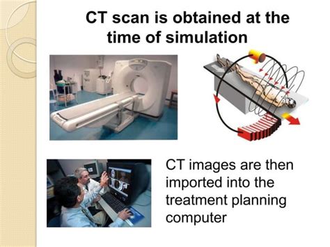 Radiation For Cervix Cancer