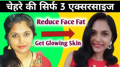 चेहरे का मोटापा कैसे कम करें Double Chin Exercise। Double Chin Kaise