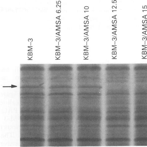 Sdspolyacrylamide Gel Electrophoresis Patterns Of Cellular Proteins Download Scientific