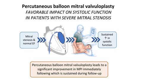 Percutaneous Balloon Mitral Valvuloplasty In Rheumatic Mitral Stenosis