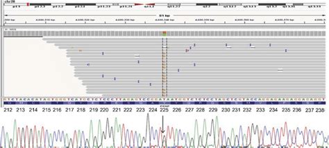 Next Generation Sequencing Data For A Patient With Prnp Tyr225cys