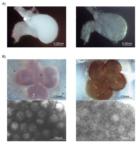 Whole Mount Immunofluorescence And Follicle Quantification Of Cultured