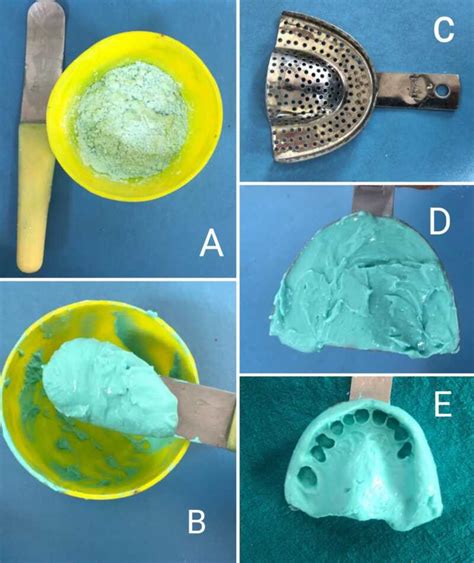 Figure Mixing Of Alginate For Impression Statpearls Ncbi