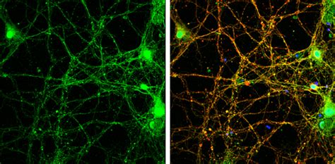 Anti-alpha Synuclein antibody (GTX133367) | GeneTex