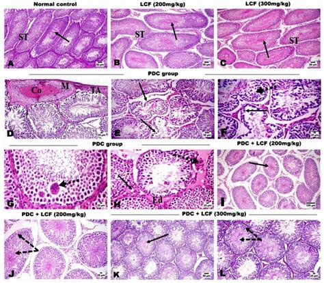 Photomicrographs Of Hande Stained Testicular Tissue Of A Normal