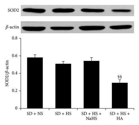 Protein Expression Of SOD1 And SOD2 In Renal Tissues Of Dahl Rats And