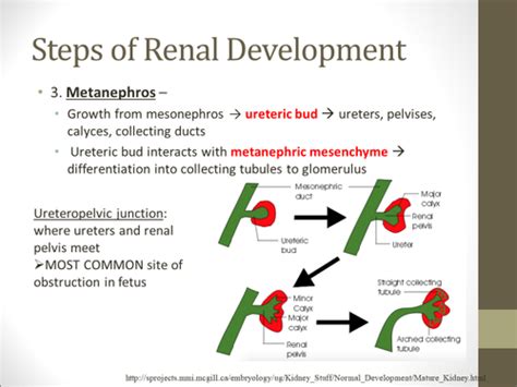 Lecture Peds Renal Flashcards Quizlet