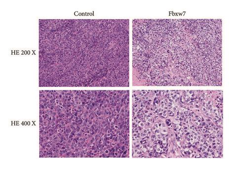 Fbxw7 Inhibits Tumor Growth In Lung Adenocarcinoma Xenograft Models Download Scientific