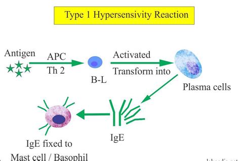 Type I Hypersensitivity Medizzy