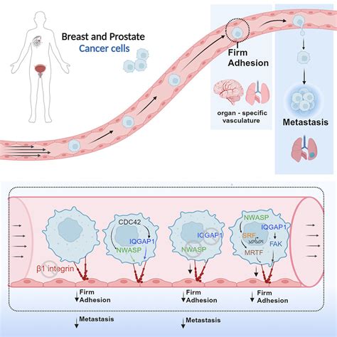 IQGAP1 And NWASP Promote Human Cancer Cell Dissemination And Metastasis