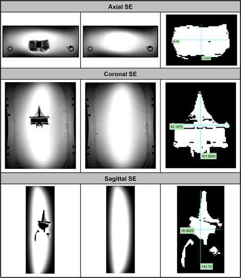 Amc Ceramic Knee With A Spin Echo Pulse Sequence In A T Mri System