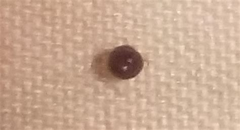 united states - What is this tiny round shiny black bug that bites ...