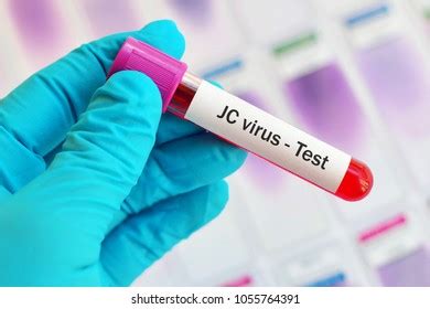 18 Virus jc Images, Stock Photos & Vectors | Shutterstock