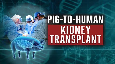 Watch Pig To Human Kidney Transplant Fox Nation