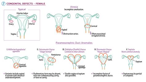 Pathology Congenital Anomalies Of The Uterus And Vagina Draw It To