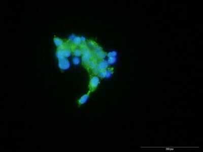 CX3CR1 Antibody H00001524 B01P Novus Biologicals