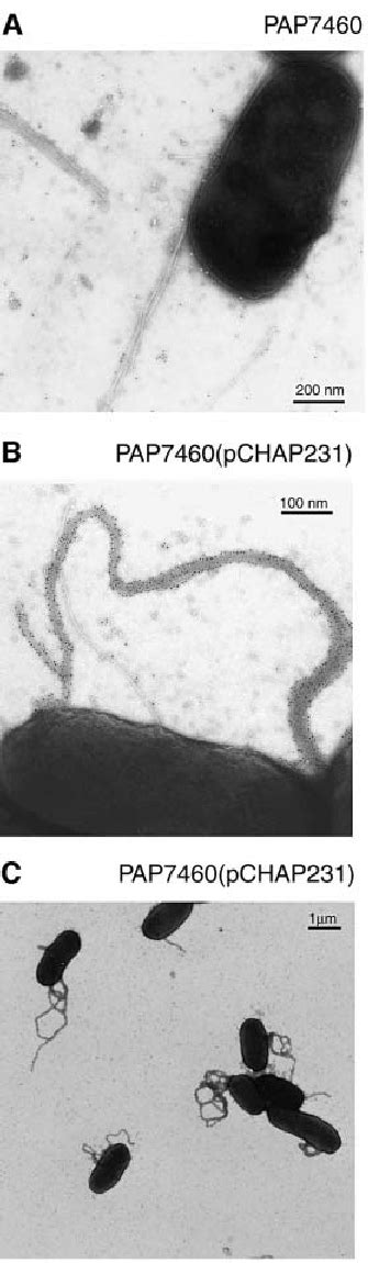 Em Analysis Of Bacteria Immunogold Labelled With Antibodies Raised