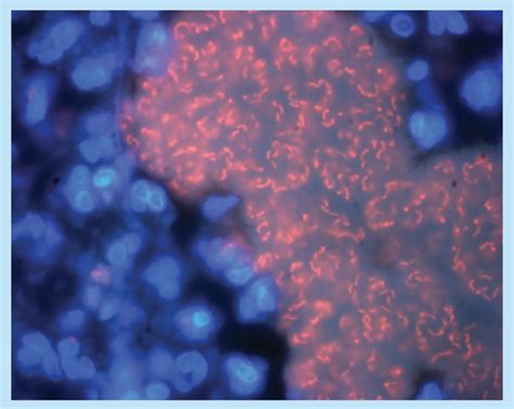 Figure From Targeting Quorum Sensing In Pseudomonas Aeruginosa