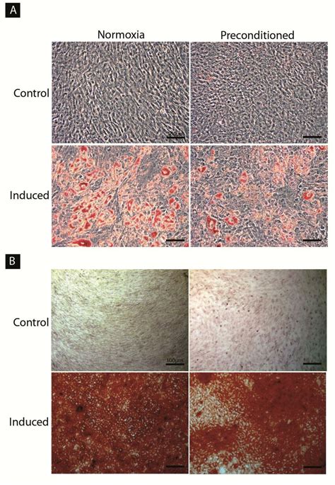 The Effect Of Hypoxic Preconditioning On Adipogenic And Osteogenic