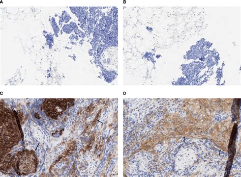 Pd L Ihc C Pharmdx Assay Agilent Technologies Bioz