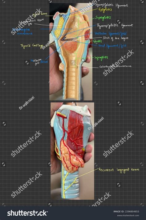 Larynx Model Labeled