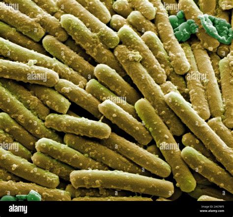 Clostridium Difficile Bacteria Coloured Scanning Electron Micrograph Sem These Rod Shaped