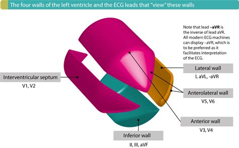 Stemi St Elevation Myocardial Infarction Diagnosis Criteria Ecg