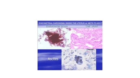 Cytopathology For Beginners Of Cytology Ppt