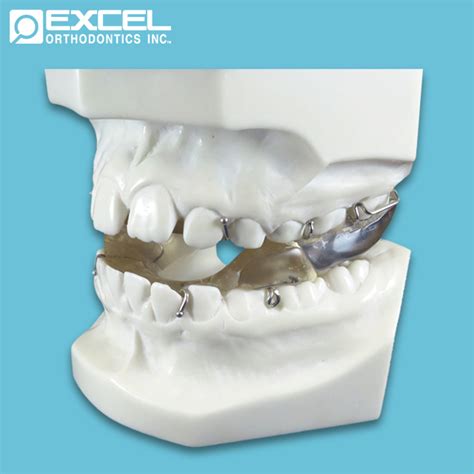 Class Correctors Excel Orthodontics