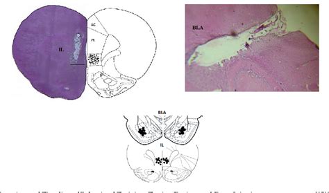 Figure 1 From Role Of Amygdala Infralimbic Cortex Circuitry In