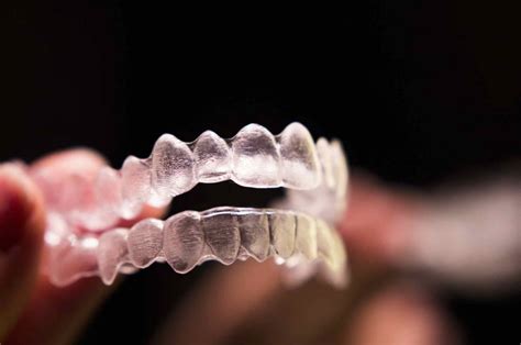 Qué son las férulas dentales Tipos y cuidados Blog Vitaldent