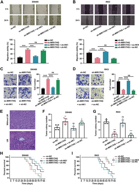 Mir17hg Promotes The Invasion And Liver Metastasis Of Crc Cells In