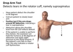 ortho tests -- technique and purpose | Quizlet