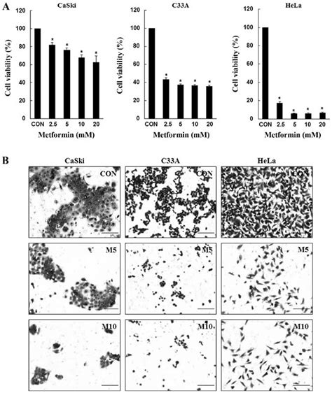 Metformin Inhibits Cervical Cancer Cell Proliferation And Migration Download Scientific