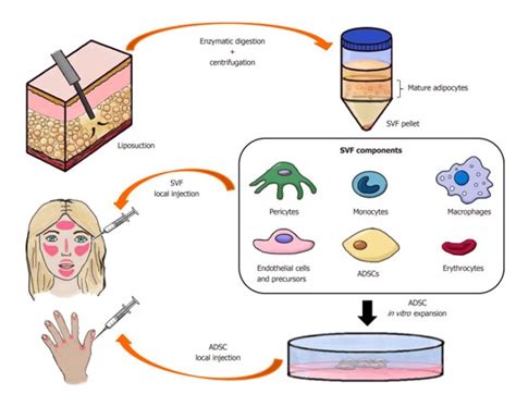 Terapia C Lulas Tronco De Tecido Adiposo Uma Nova Alternativa Para