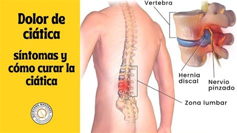 Ci Tica Cu Les Son Sus Causas S Ntomas Y Tratamiento Fisiopremium