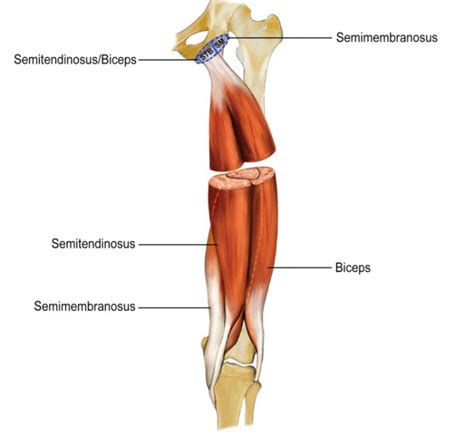 Chronic Hamstring Tendinopathy A Review Sports Medicine Review